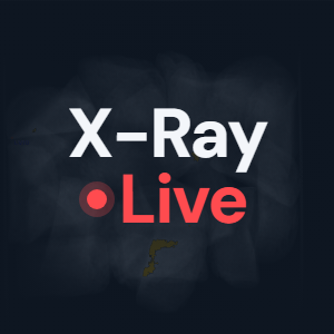 X-Ray Live